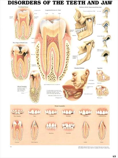 plansze dydaktyczne - budowa ciała człowieka ENG - 45-Choroby szczęki i zębów.jpg