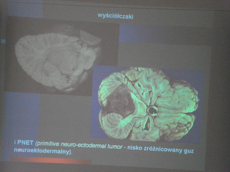 Neurologia dziecięca - DSC00181.JPG