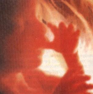 ABORCJA-WSPÓŁCZESNA RZEŻ NIEWINIĄTEK - foto7.jpg